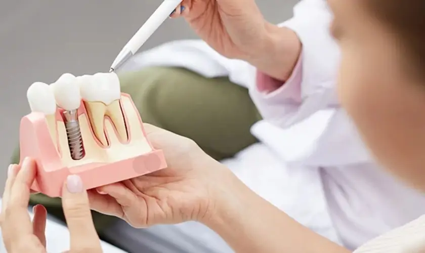 5 Life-Changing Benefits Of Dental Implants You Should Consider
