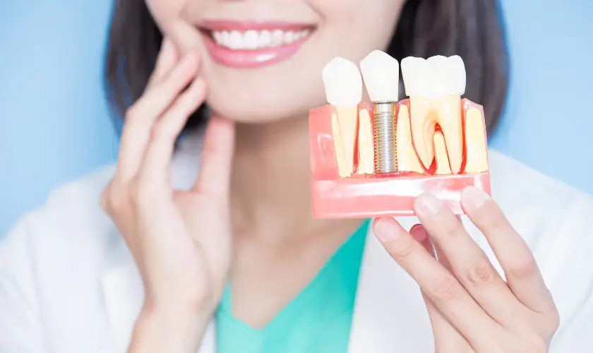 How Dental Implants Have Evolved Over the Years: Technological Advances