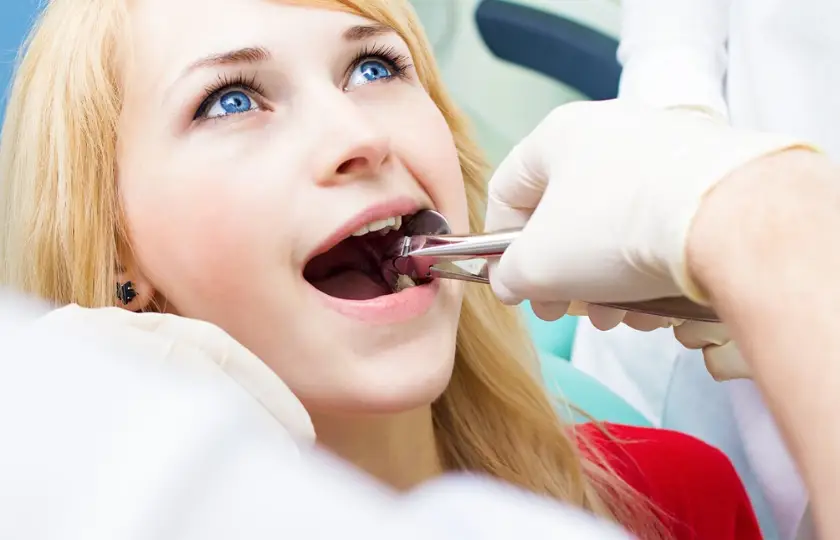 how to control bleeding after tooth extraction