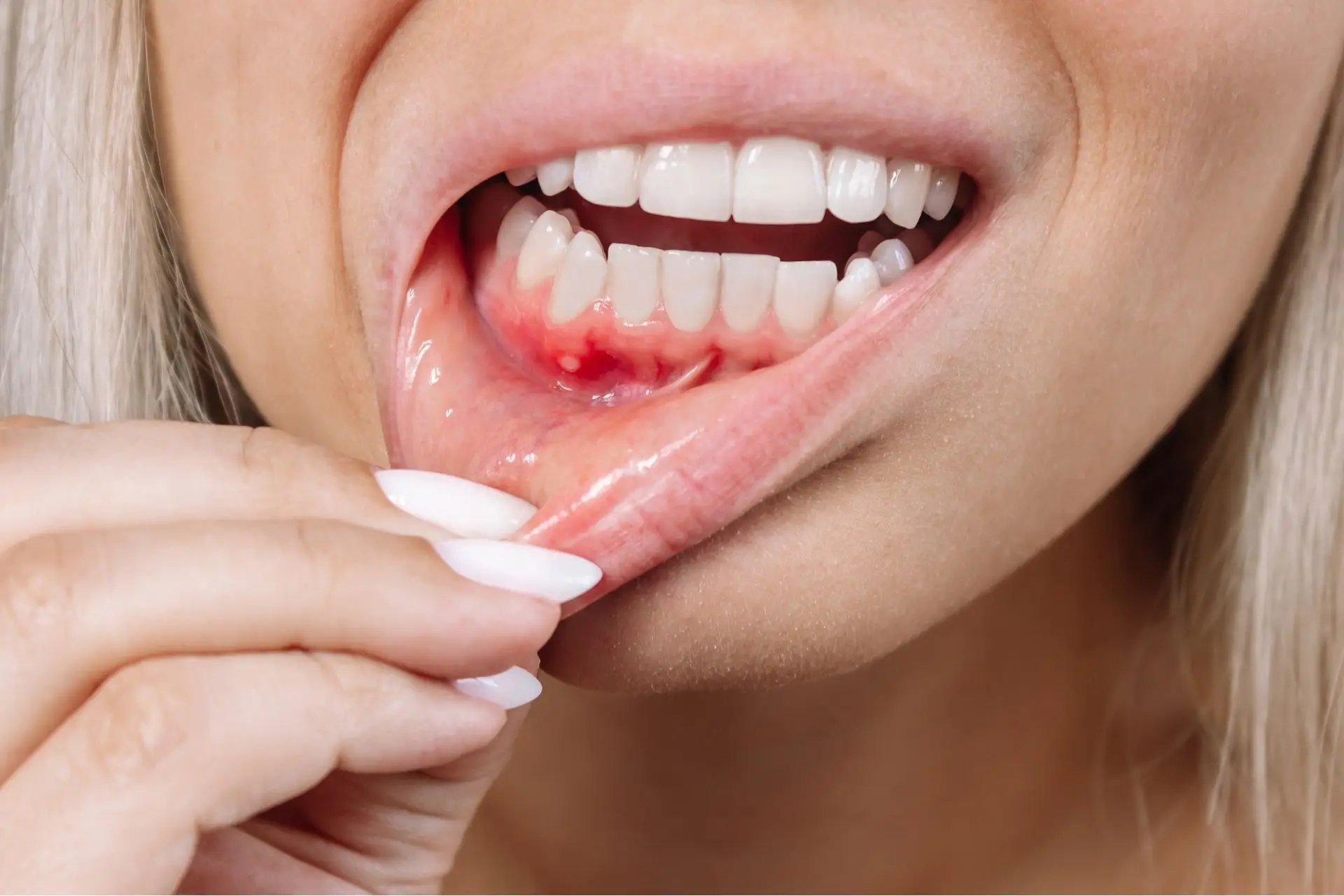 Gum Disease & Your Health: Risks, Prevention, and Treatment