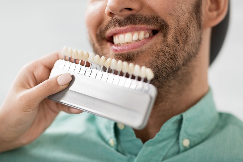 Blue Jay Family Dentistry | Dental Veneers