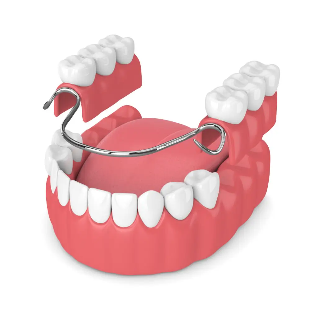 Full vs. Partial Dentures in Maplewood, MN: Which Option Is Right for You?