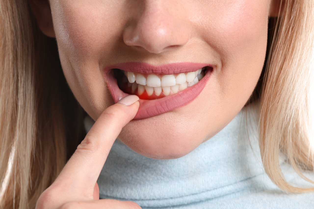Bleeding Gums When Brushing: When Should You Consider Gum Disease Therapy in Maplewood, MN?